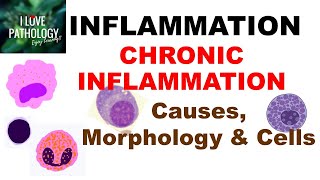 INFLAMMATION 8 CHRONIC INFLAMMATION Causes Morphology amp Cells [upl. by Mahda425]