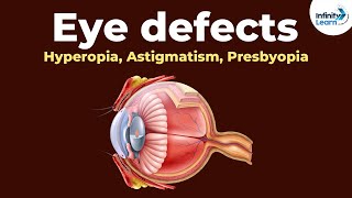 Presbyopia Correction Eye Drops Vs Reading Glasses  Presbyopia Treatment [upl. by Issirk]