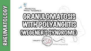 INFLAMMATION Part 9 Chronic Inflammation  GRANULOMATOUS INFLAMMATION [upl. by Nnaed]