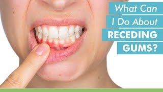 What Can I Do About Receding Gums [upl. by Itsirhc]