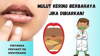 Mulut Sering Kering Ketahui Penyebabnya Ini [upl. by Anaihs]