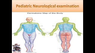 Pediatric Neurological examination [upl. by Eillah494]