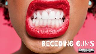 How Dentists Treat Receding Gums [upl. by Elsey]