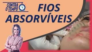 Fios Absorvíveis Descubra os tipos de fios existentes [upl. by Quinlan]