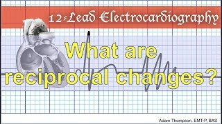 What are reciprocal changes [upl. by Ivanah]