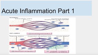 Acute Inflammation Part 1 [upl. by Imehon]