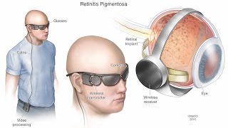 Histology Of Retina [upl. by Justen96]